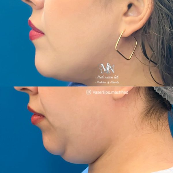  کار کلینیک مهنائین 14 600x600