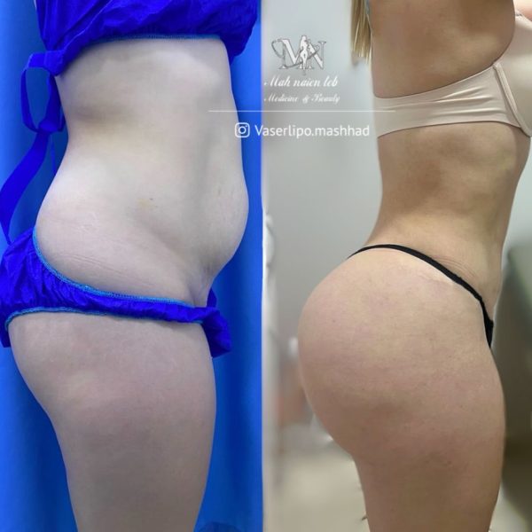  کار کلینیک مهنائین 16 600x600