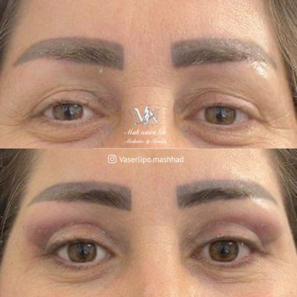  کار کلینیک مهنائین 3 600x600