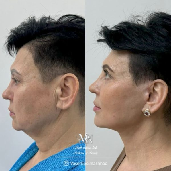  کار کلینیک مهنائین 5 600x600