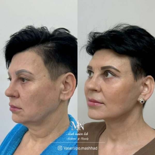  کار کلینیک مهنائین 7 600x600